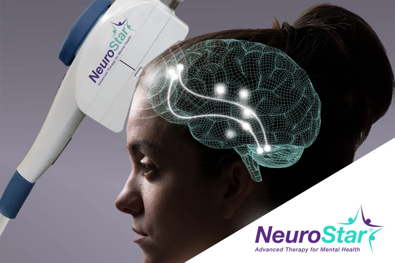 NeuroStar TMS Therapy